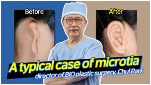 Read more about the article A typical case of microtia, director of BIO plastic surgery, Chul Park