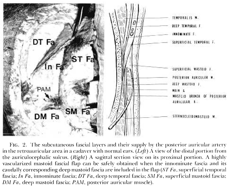 Read more about the article A single-stage two-flap method of total ear reconstruction