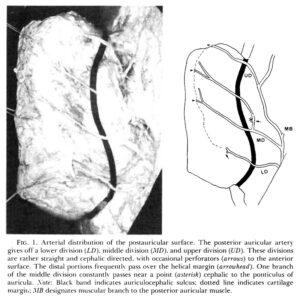 Read more about the article A new arterial flap from the postauricular surface: its anatomic basis and clinical application [1988 Sep] C Park