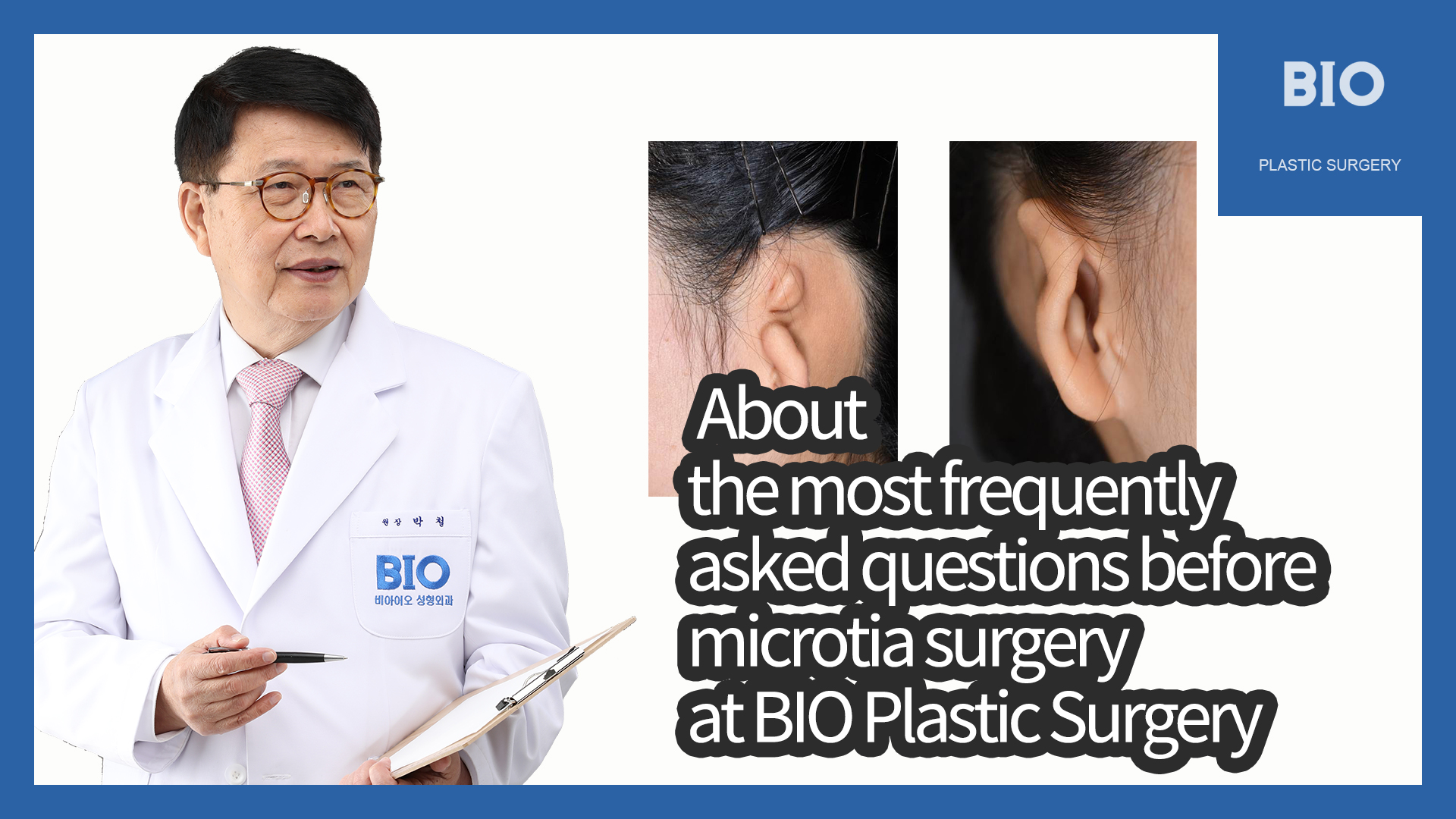 You are currently viewing About the most frequently asked questions before microtia surgery at BIO Plastic Surgery